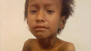 Desgarrador. Néstor Femenía, el nene qom desnutrido y enfermo de tuberculosis que murió ayer en la Provincia del Chaco.